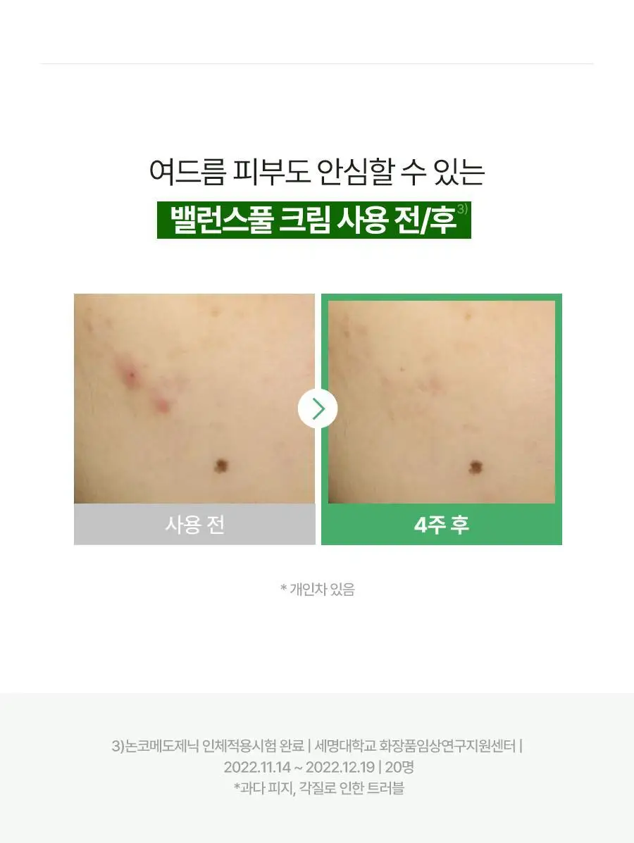 [단독기획] 토리든 밸런스풀 시카 진정 크림 80ml 기획 (+세럼 10ml) 상세페이지 25